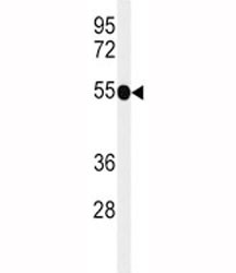 Anti-CD30