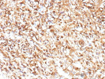 Anti-CD99 / CD99 molecule, clone MIC2/9939R