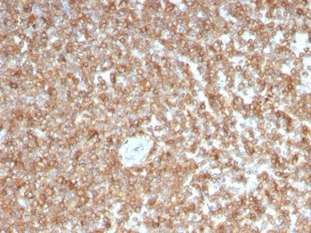 Anti-Granulocyte-Macrophage CSF / CSF2, clone CSF2/3403