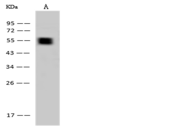 Anti-Cytokeratin 7/KRT7 Monoclonal Recombinant Antibody