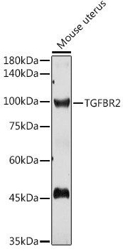 Anti-TGFBR2 [Rabbit] (CAB11788)