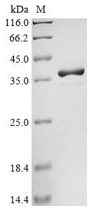 11S globulin seed storage protein 2, partial, Sesamum indicum, recombinant