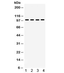 Anti-MAPK6
