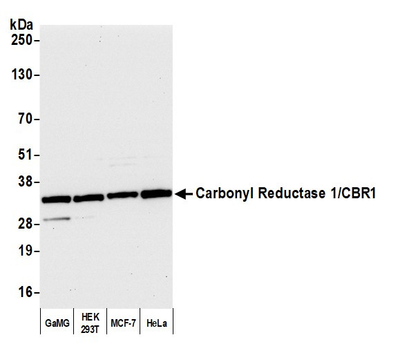 Anti-Carbonyl Reductase 1/CBR1