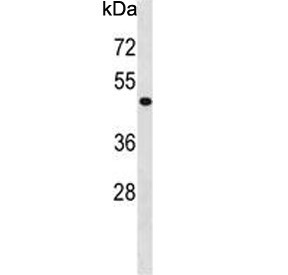 Anti-PHKG2