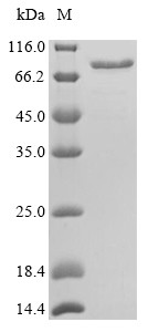 Calreticulin (Calr), mouse, recombinant