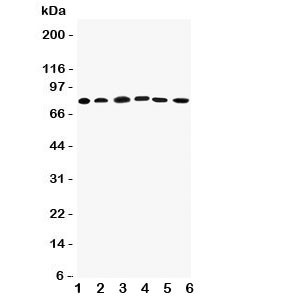 Anti-Proprotein Convertase 1/3