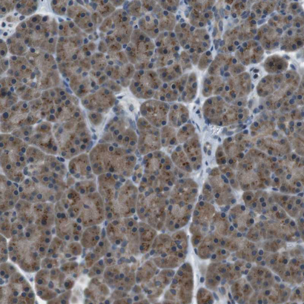 Anti-FAM3B