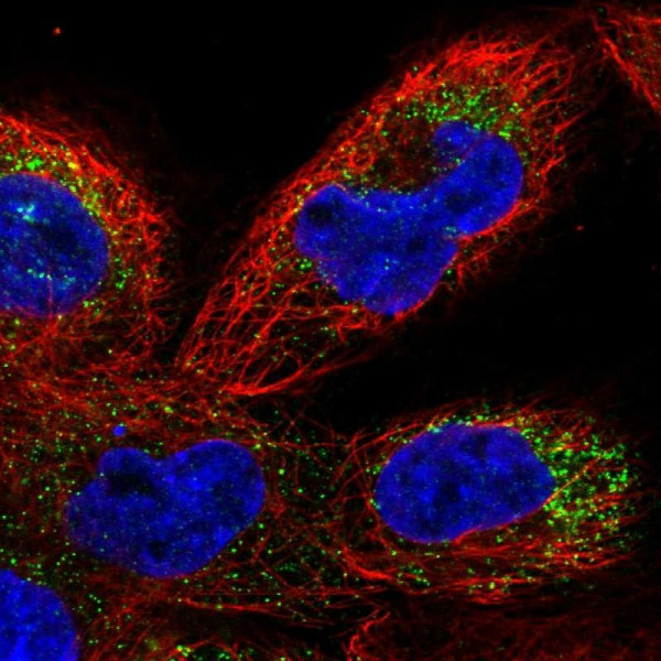 Anti-TMEM41B