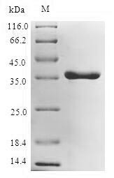 UDP-3-O-acyl-N-acetylglucosamine deacetylase (lpxC), Escherichia coli, recombinant