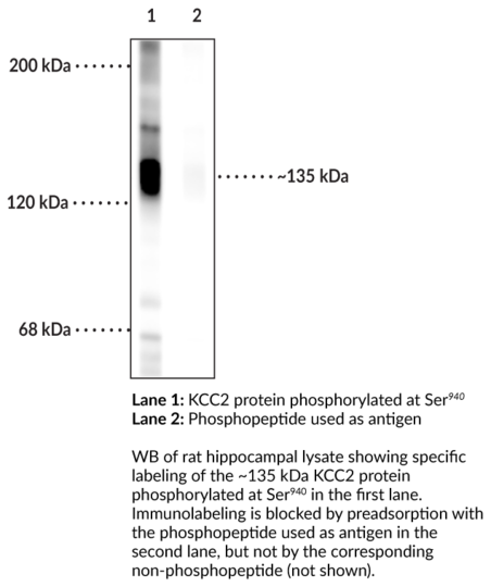 Anti-KCC2 (Phospho-Ser940)