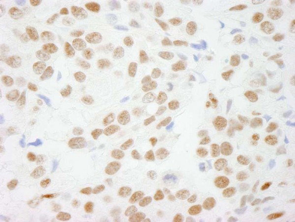 Anti-CTBP1 (IHC)