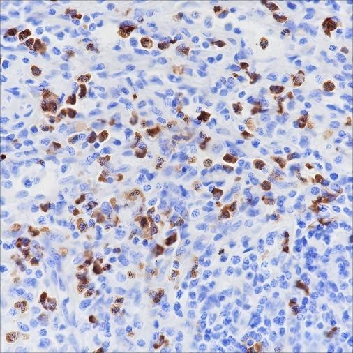 Anti-Recombinant CD15/SSEA1, clone A159