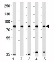 Anti-Insulin Receptor Related (INSRR)