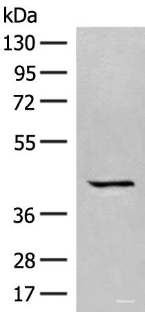 Anti-GPR62