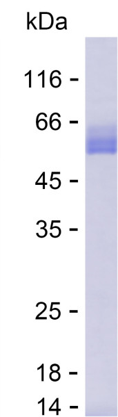 Recombinant Human DDAH2 Protein