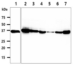 Anti-CPOX, clone 36B10
