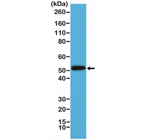 Anti-Cytokeratin-14 / CK14 / KRT14, clone RM328