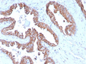 Anti-TMEPAI / PMEPA1, clone PMEPA1/2696