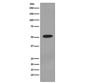 Anti-KRT7 / Cytokeratin 7, clone EBC-11