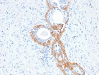 Anti-Cytokeratin, Basic (Type II or HMW) Recombinant Mouse Monoclonal Antibody (clone:rKRTH/2148)