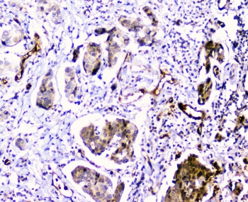 Anti-CDA / Cytidine deaminase