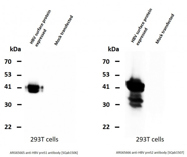 Anti-HBV preS1, clone SQab1506