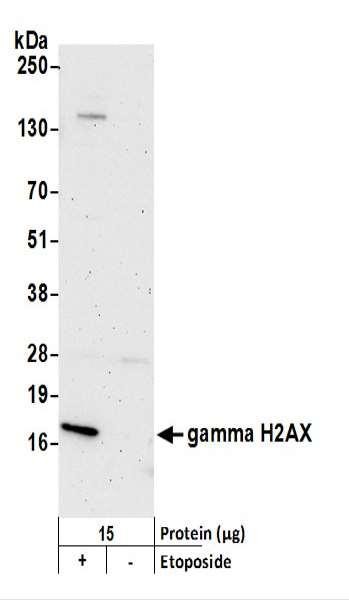 Anti-gamma-H2AX