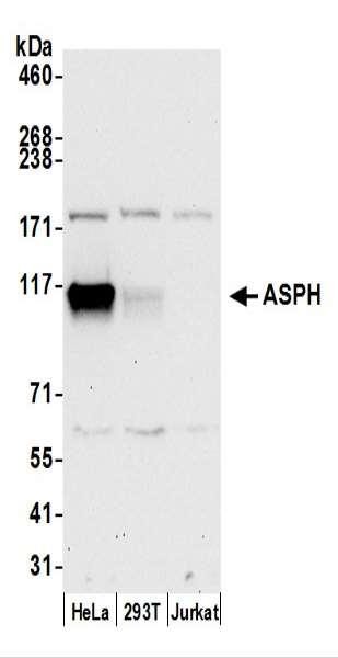 Anti-ASPH