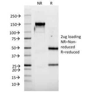 Anti-Interferon alpha 2 (IFNA2), clone N39