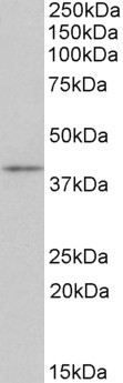Anti-CD28