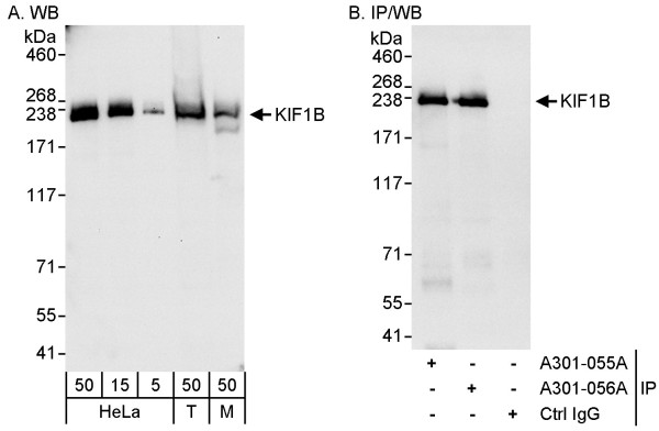 Anti-KIF1B