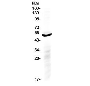 Anti-IL6R (C-Terminal Region)