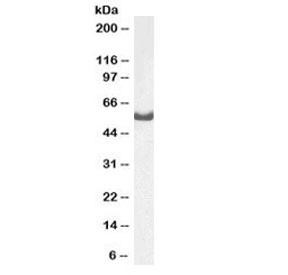 Anti-Dars / Aspartyl-tRNA synthetase
