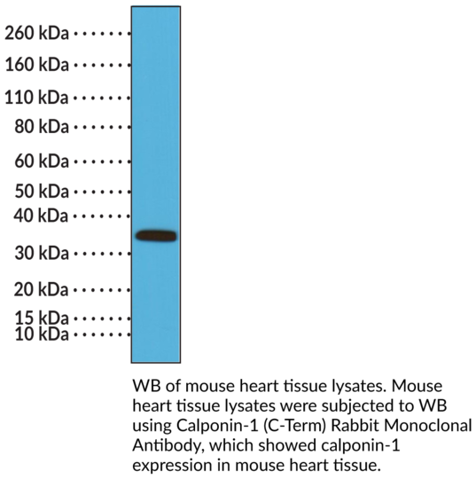 Anti-Calponin-1 (C-Term) Rabbit Monoclonal Antibody (Clone RM262)