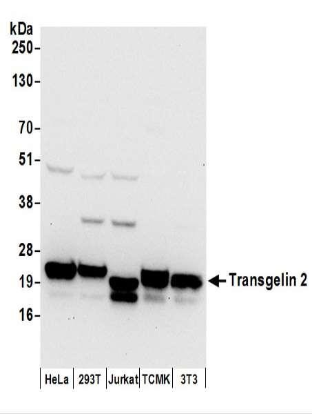 Anti-Transgelin 2
