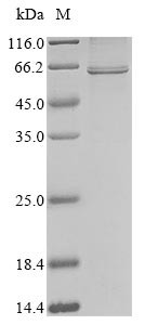Nucleoprotein (N), human coronavirus HKU1, recombinant
