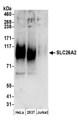 Anti-SLC26A2