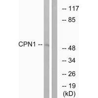Anti-CPN1