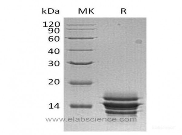 C-X-C Motif Chemokine 7/CXCL7/NAP-2 Protein(C-6His) (recombinant human)