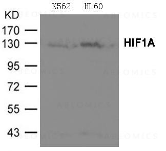 Anti-HIF1A