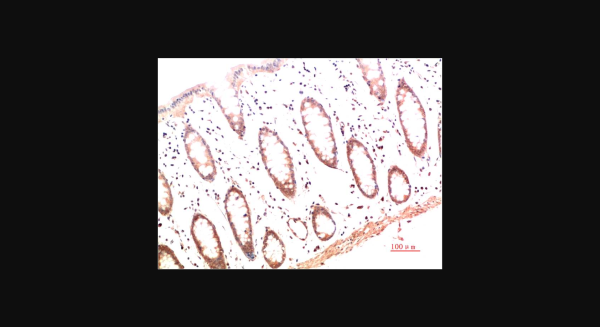 Anti-Collagen I (4B5), monoclonal