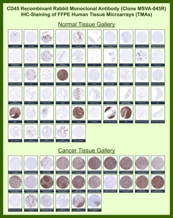 Anti-CD45 for IHC / Leukocyte Common Antigen, clone MSVA-045R