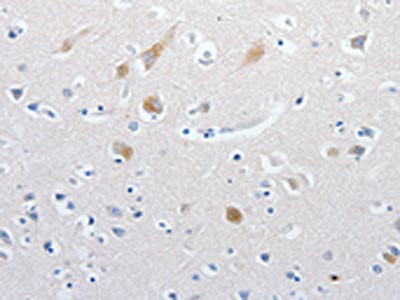 Anti-MATN1