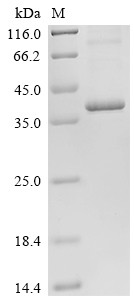 Metalloreductase STEAP1 (STEAP1), human, recombinant