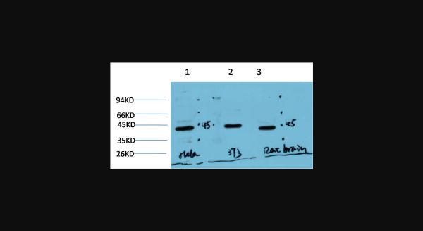 Anti-Muscle actin (3E9), monoclonal