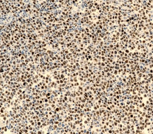 Anti-FOXP1, clone SQab19159