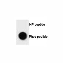 Anti-phospho-ULK1 (Ser317)