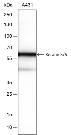Anti-Recombinant Keratin 5/6, clone A280
