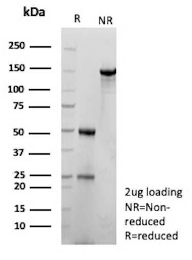 Anti-CEACAM1 (CEA Cell Adhesion Molecule 1), recombinant antibody, clone r29H2